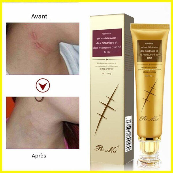 🌿Gel Anti-Cicatrices Miracle – Efface Marques & Acné en 14 Jours !  (8)8 total des critiques
