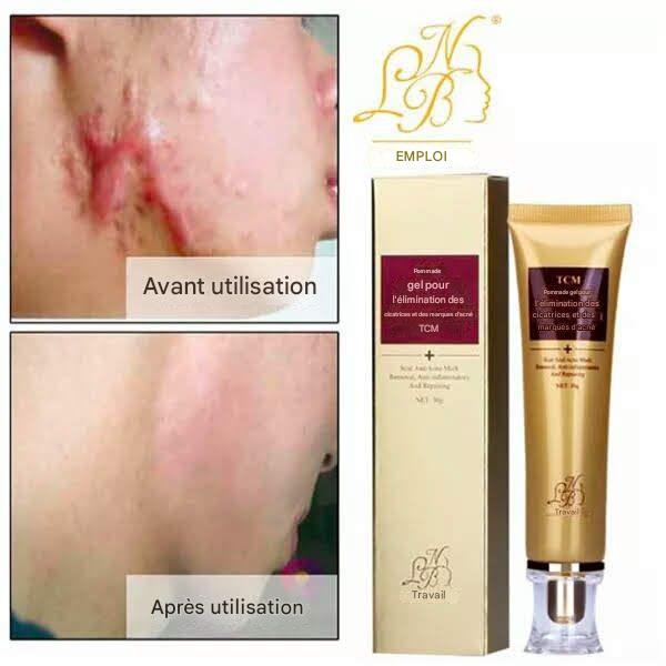 🌿Gel Anti-Cicatrices Miracle – Efface Marques & Acné en 14 Jours !  (8)8 total des critiques